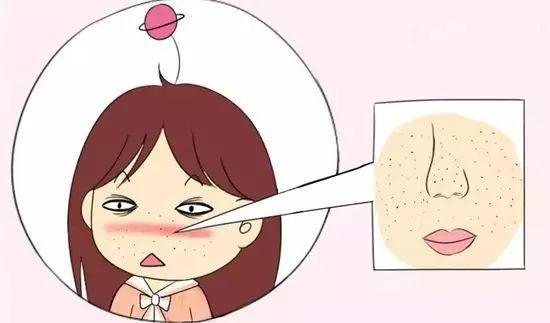 女生毛孔粗大到底應(yīng)該怎么辦? 女生毛孔粗大到底應(yīng)該怎么辦?