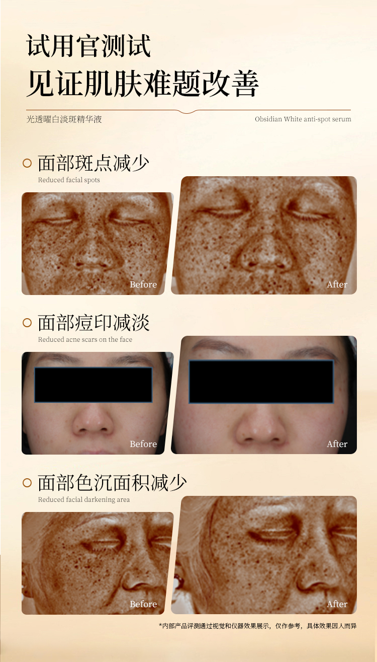 光透曜白淡斑精華液_10.jpg